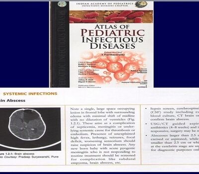 ATLAS of Pediatric Infectious Diseases